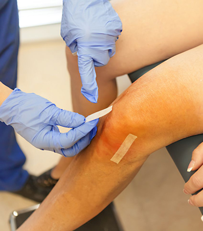 arthroscopic Surgery