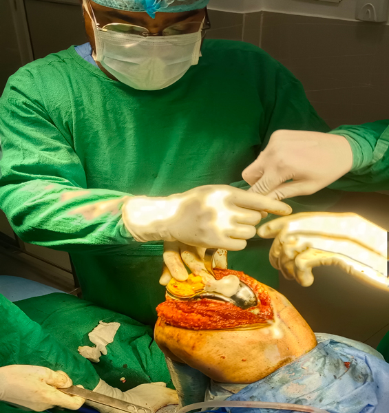 Dr. Ankit Agrawal Best Orthopaedic Surgeon, Best Orthopaedic Surgeon in Mathura, best doctor Dr. Ankit Agrawal in Mathura,orthopedic doctor in mathura, hip replacement in mathura, best doctor in mathura , Best Orthopaedic Surgeon in Mathura, knee replacement in mathura, best doctor Dr. Ankit Agrawal in Mathura 