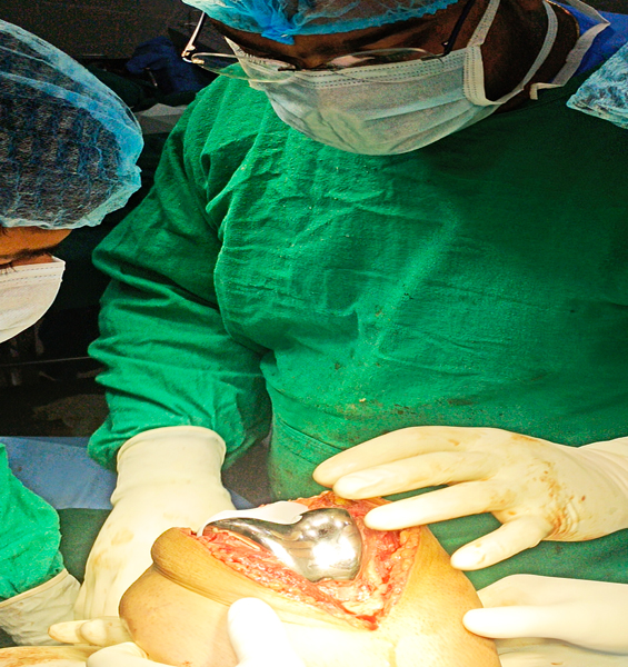 Dr. Ankit Agrawal Best Orthopaedic Surgeon, Best Orthopaedic Surgeon in Mathura, best doctor Dr. Ankit Agrawal in Mathura,orthopedic doctor in mathura, hip replacement in mathura, best doctor in mathura , Best Orthopaedic Surgeon in Mathura, knee replacement in mathura, best doctor Dr. Ankit Agrawal in Mathura