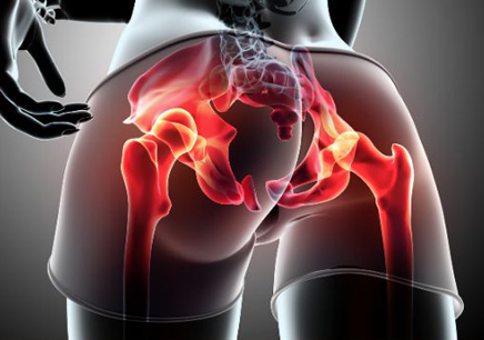 Hip Replacement Surgeon