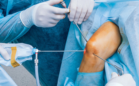 Dr. Ankit Agrawal Best Orthopaedic Surgeon, Best Orthopaedic Surgeon in Mathura, best doctor Dr. Ankit Agrawal in Mathura,orthopedic doctor in mathura, hip replacement in mathura, best doctor in mathura , Best Orthopaedic Surgeon in Mathura, knee replacement in mathura, best doctor Dr. Ankit Agrawal in Mathura